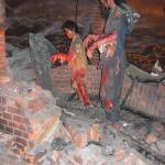 People were walking around with shredded skin hanging from their limbs after the bombing